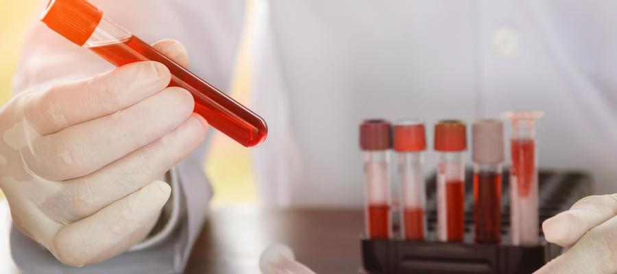 gloved hand holding test tube